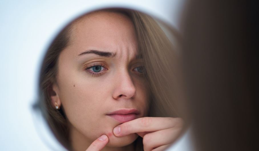 Best essential oil for acne